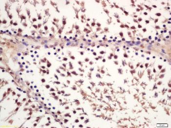 Phospho-GSK-3 Beta (Ser21) Rabbit Polyclonal Antibody