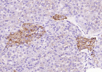 Phospho-GSK3 Beta (Tyr216) Rabbit Polyclonal Antibody