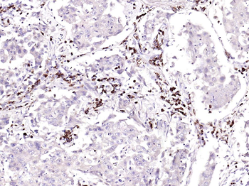 GSTA3 Rabbit Polyclonal Antibody