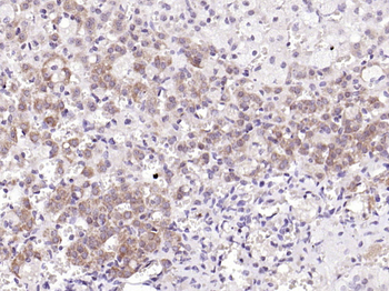 GSTA3 Rabbit Polyclonal Antibody