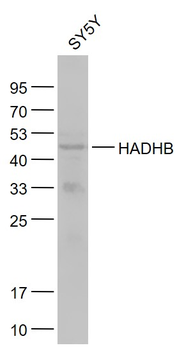 HADHB Rabbit Polyclonal Antibody