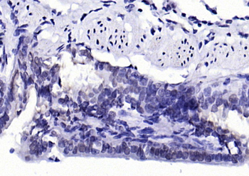 Phospho-H2AX (Tyr143) Rabbit Polyclonal Antibody