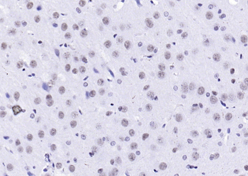 Phospho-H2AX (Tyr143) Rabbit Polyclonal Antibody