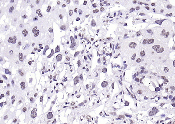 Phospho-H2AX (Tyr143) Rabbit Polyclonal Antibody