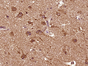 Phospho-TSC1 (Ser505) Rabbit Polyclonal Antibody