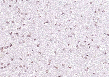 HES5 Rabbit Polyclonal Antibody