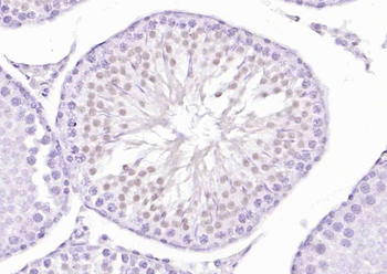 HES5 Rabbit Polyclonal Antibody