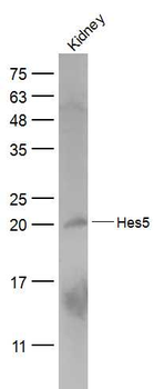 HES5 Rabbit Polyclonal Antibody