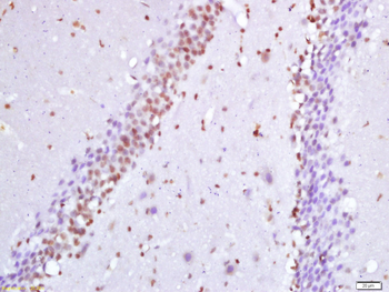 HES5 Rabbit Polyclonal Antibody