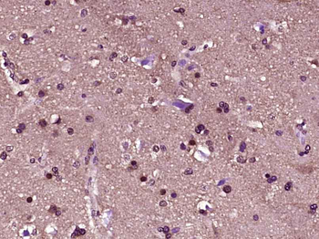 Phospho-HDAC1 (Ser423+Ser421) Rabbit Polyclonal Antibody