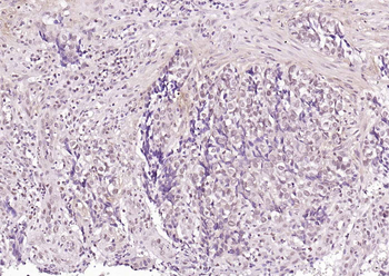 Caveolin-2 Rabbit Polyclonal Antibody