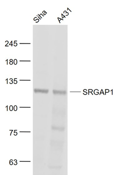 SRGAP1 Rabbit Polyclonal Antibody