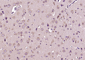 ABL2 Rabbit Polyclonal Antibody