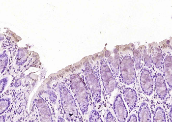 PLK1 Rabbit Polyclonal Antibody