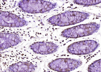 OSMR Rabbit Polyclonal Antibody