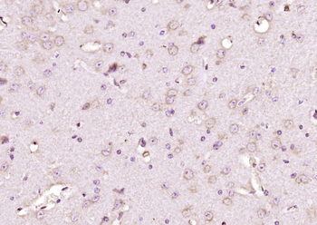 CK II beta Rabbit Polyclonal Antibody