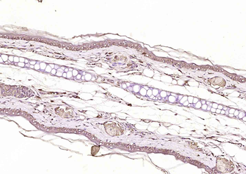Axin1 Rabbit Polyclonal Antibody