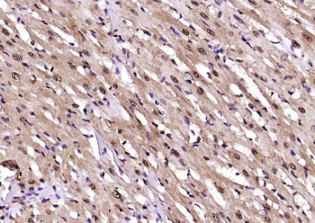 NEK6 Rabbit Polyclonal Antibody
