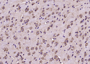 Notch 2 Rabbit Polyclonal Antibody