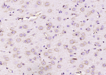 Notch 2 Rabbit Polyclonal Antibody