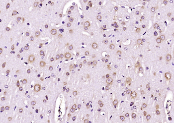 Glutathione Reductase Rabbit Polyclonal Antibody