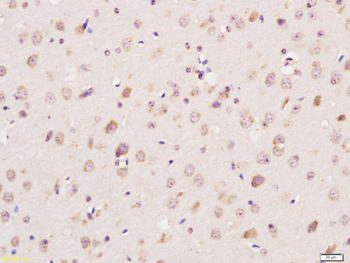 Ceramide glucosyltransferase Rabbit Polyclonal Antibody