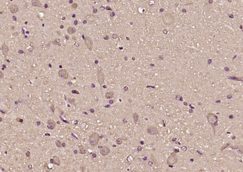 ITM2B Rabbit Polyclonal Antibody