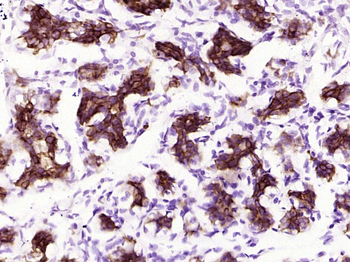 Phospho-GSK-3 Beta (Ser9) Recombinant Rabbit Monoclonal Antibody