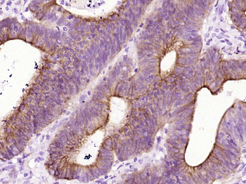 Phospho-GSK-3 Beta (Ser9) Recombinant Rabbit Monoclonal Antibody