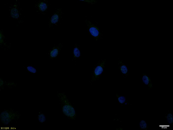 Smad2 Recombinant Rabbit Monoclonal Antibody