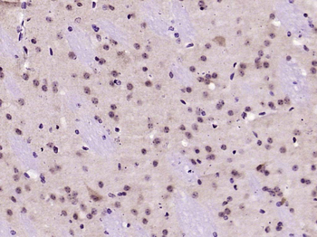 Smad2 Recombinant Rabbit Monoclonal Antibody