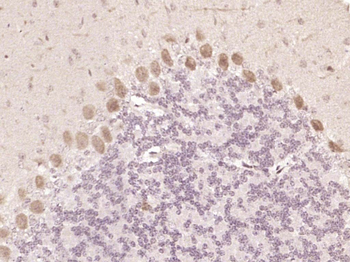 Smad2 Recombinant Rabbit Monoclonal Antibody