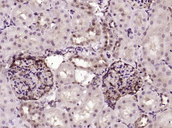 Smad2 Recombinant Rabbit Monoclonal Antibody