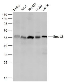 Smad2 Recombinant Rabbit Monoclonal Antibody