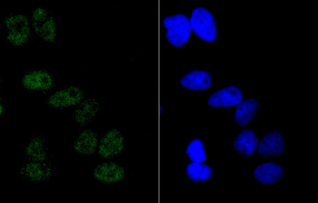Cyclin E1 Recombinant Rabbit Monoclonal Antibody