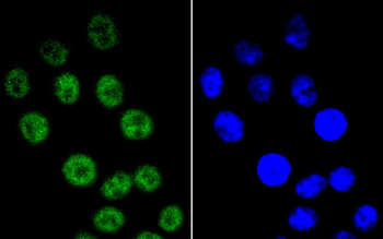 Cyclin E1 Recombinant Rabbit Monoclonal Antibody