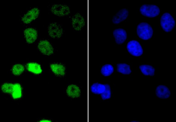 Cyclin E1 Recombinant Rabbit Monoclonal Antibody