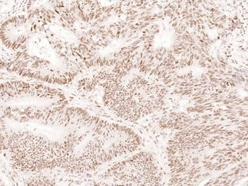 Cyclin E1 Recombinant Rabbit Monoclonal Antibody