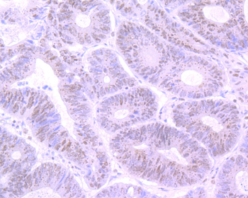 Cyclin E1 Recombinant Rabbit Monoclonal Antibody