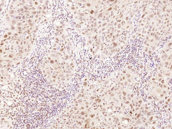 Cyclin E1 Recombinant Rabbit Monoclonal Antibody