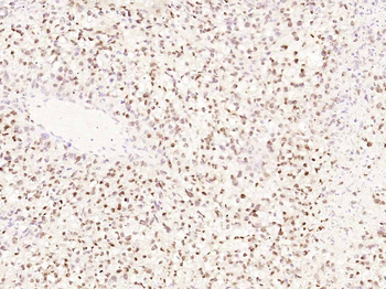 Cyclin E1 Recombinant Rabbit Monoclonal Antibody