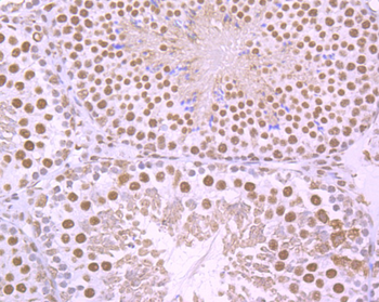 Cyclin E1 Recombinant Rabbit Monoclonal Antibody