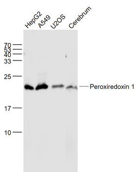 Peroxiredoxin 1 Recombinant Rabbit Monoclonal Antibody
