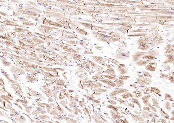 Desmin (ready to use) Mouse Monoclonal Antibody