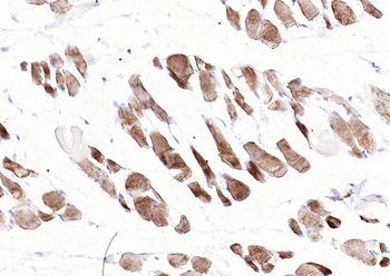 Desmin (ready to use) Mouse Monoclonal Antibody