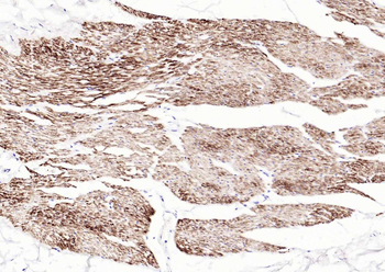 Desmin (ready to use) Mouse Monoclonal Antibody