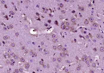 PCSK1/NEC1 Rabbit Polyclonal Antibody