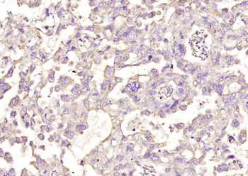 NCR1 Rabbit Polyclonal Antibody