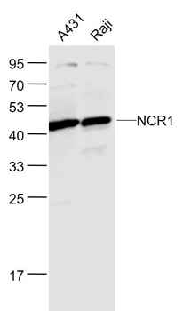 NCR1 Rabbit Polyclonal Antibody
