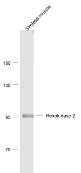 Hexokinase 2 Rabbit Polyclonal Antibody